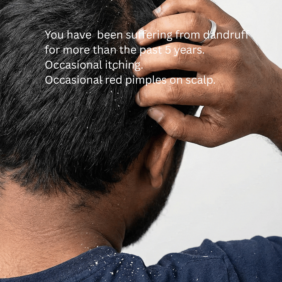 KeshaRaksha - Anti Fungal Oil