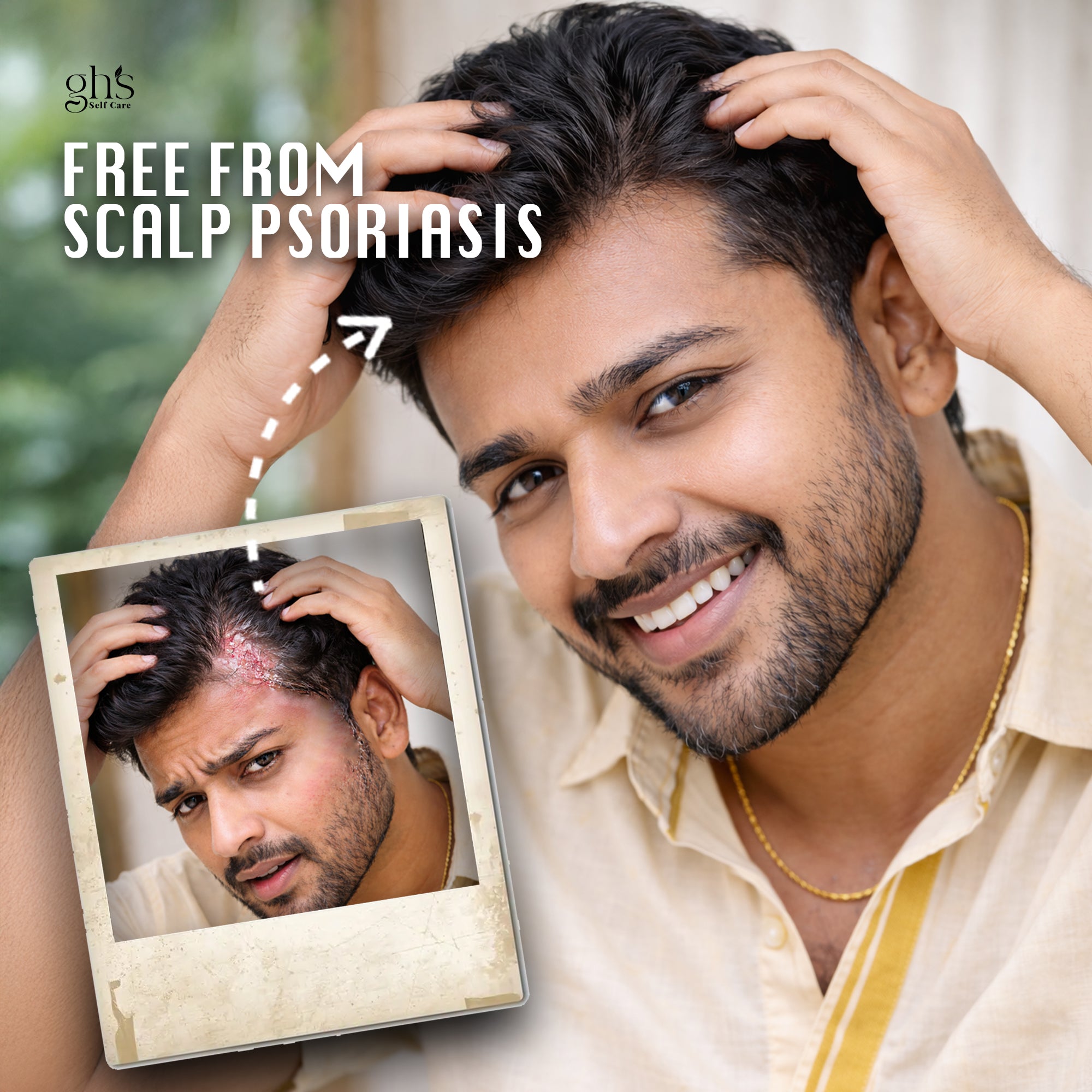 KeshaRaksha - Anti Fungal Oil