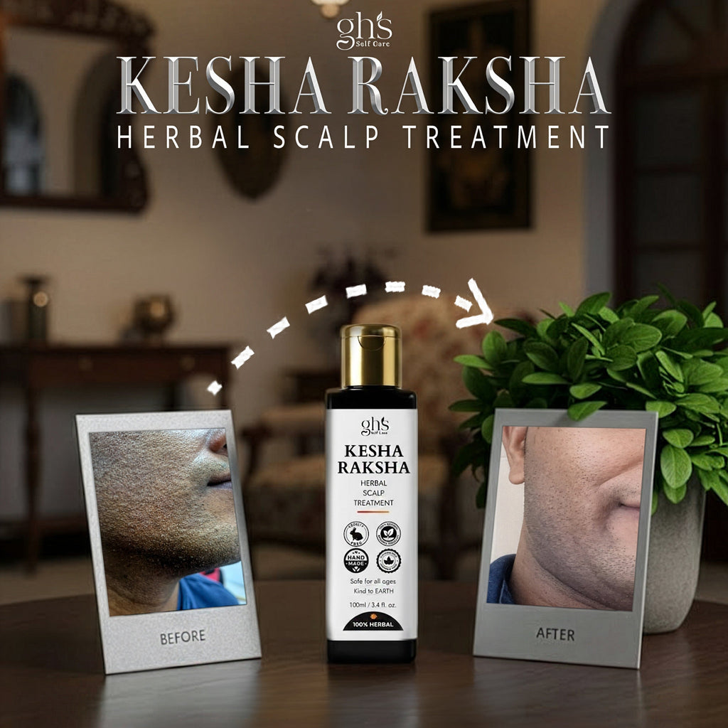 Kesha Raksha herbal scalp treatment bottle with 'Before' and 'After' images on a wooden surface.